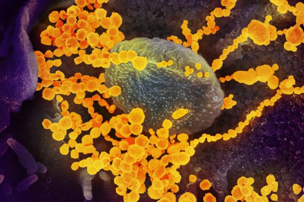 First person in South Africa tests positive for COVID-19 virus