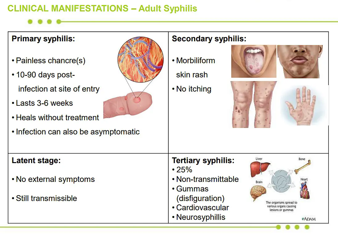 Syphilis Infection Syphilis rates are spiking around the world • Spotlight