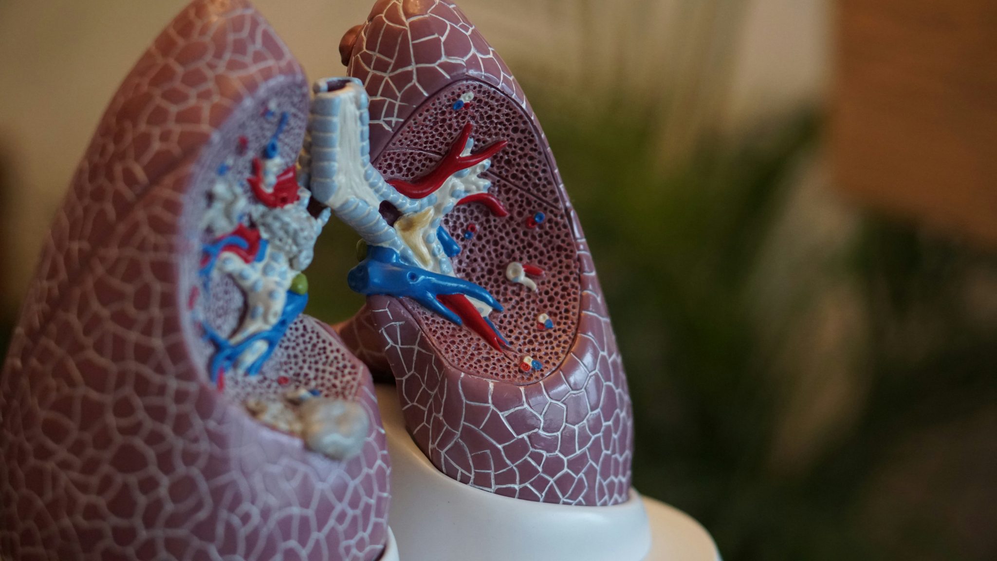 New Study Highlights Importance of TB Testing in South Africa