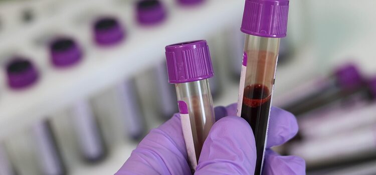 In The Spotlight | A fungal infection that targets the brain claims many lives in SA, stopping it won’t be easy