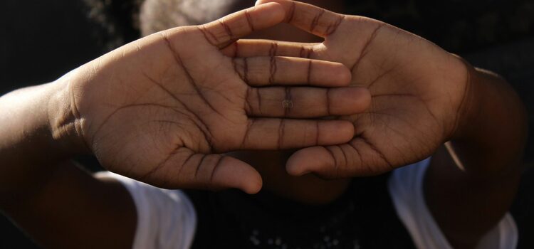 Closing the gap is not enough for children born with cleft lip or cleft palate